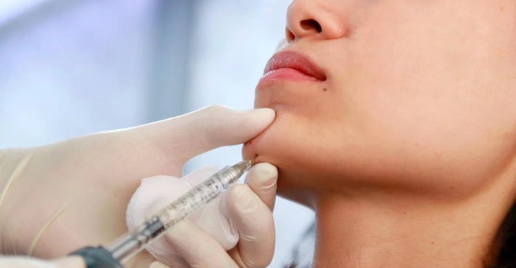 Chin Augmentation Surgery