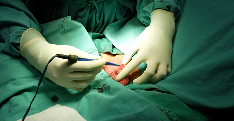 Circumcision Treatment