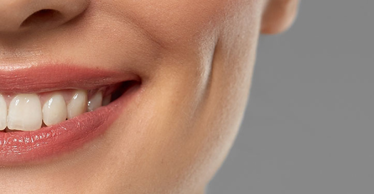 Dimple Creation