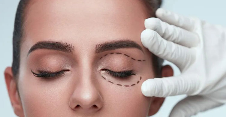 Eyelid Surgery