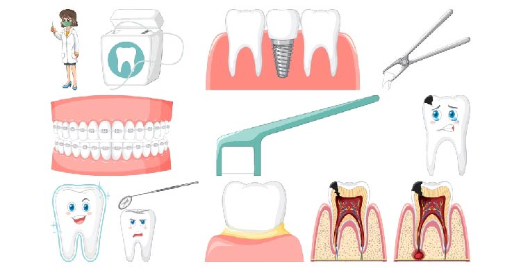 Full Mouth Rehabilitation
