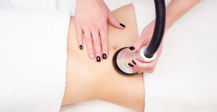 Laser Liposuction