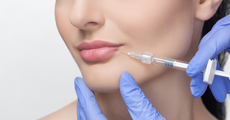 Lip Augmentation