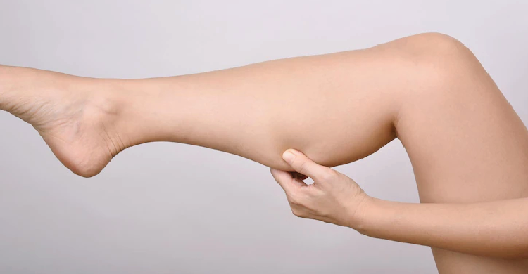 Calf Liposuction