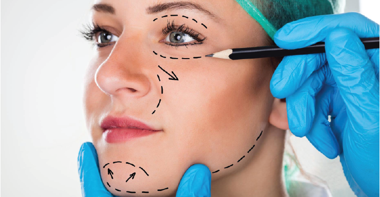 Facial Liposuction