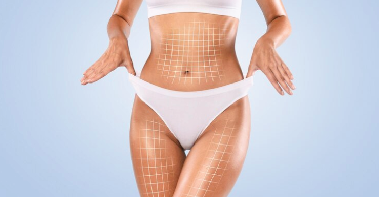Female Liposuction