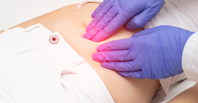 Ovarian Cyst Treatment