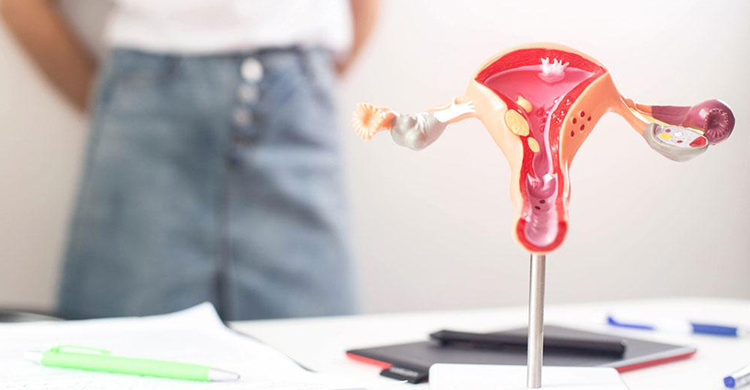 PCOD/PCOS Treatment